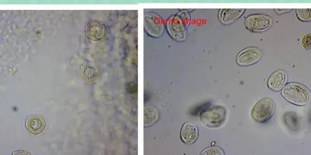 草鱼养殖户如何区别确诊斜管虫、车轮虫？