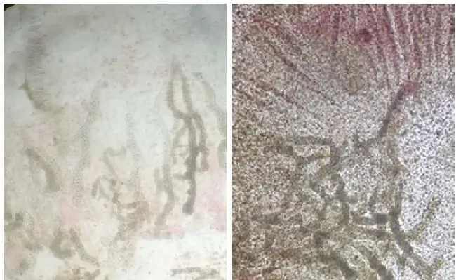 鱼鳃霉病的诊断误区和临床诊断方法