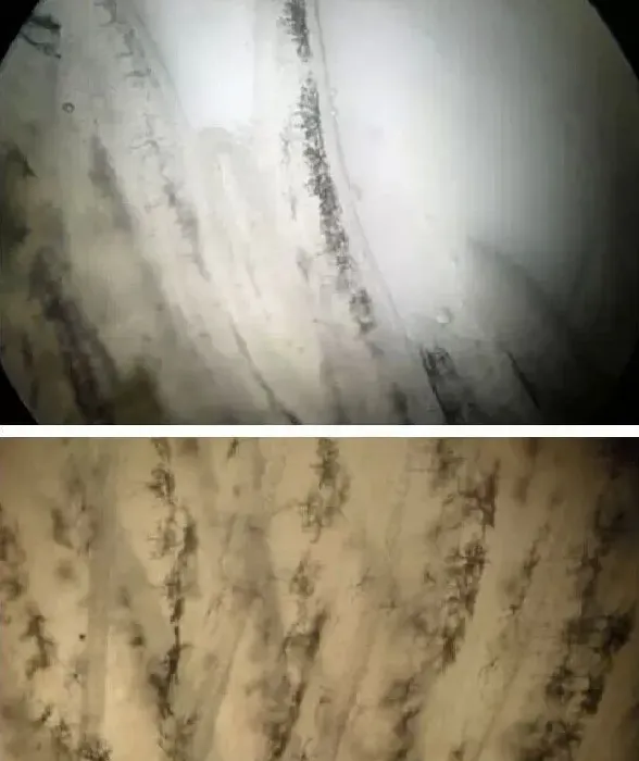 鱼鳃霉病的诊断误区和临床诊断方法