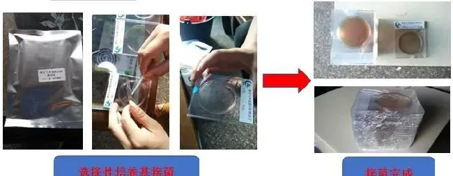 你的青鱼塘发病率高，或许和塘里面的嗜水气单胞菌有关