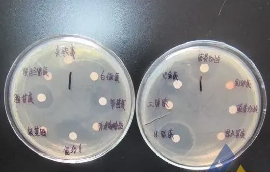 [病例471]巴沙鱼细菌性败血症