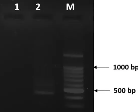 论文解读--创伤弧菌感染基因改良罗非鱼病理学研究