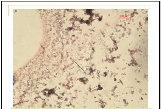 江兴龙教授谈池塘生物膜低碳养殖技术