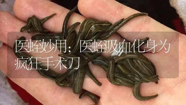 医蛭妙用：医蛭吸血化身为疯狂手术刀 | 特种养殖