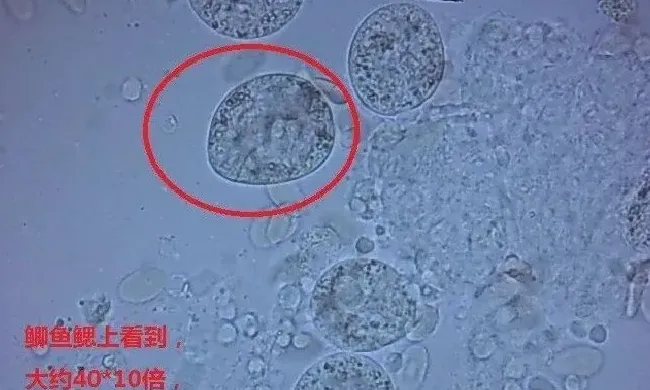 谨防孢子虫的危害！如何迅速识别孢子虫并杀灭？