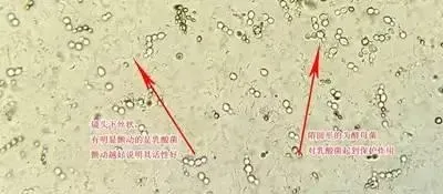 好的乳酸菌能抑制南美白对虾副溶血弧菌？