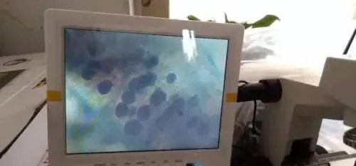金鲳鱼白点病的预防方法