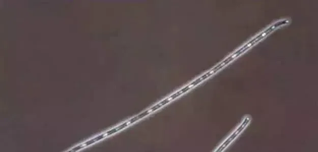 水产养殖户如何分清类型杀蓝藻？