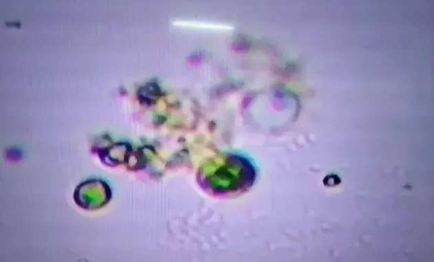 高温天气，水产养殖户要慎用芽孢杆菌