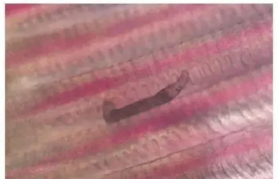 这几种鱼类常见寄生虫，你都了解了吗？