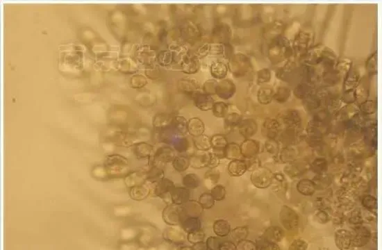 南美白对虾塘纤毛虫的防治方案