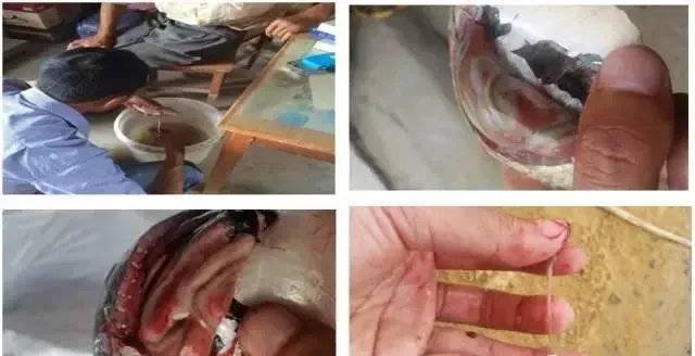 “鲫鱼鳃出血”防控技术 海大又有新发现