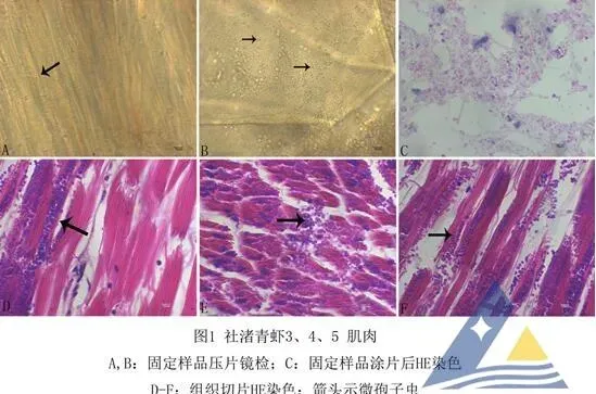 [每周一例]青虾发生微孢子虫病慢性死亡