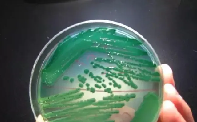 南美白对虾养殖过程中关于弧菌的那些事