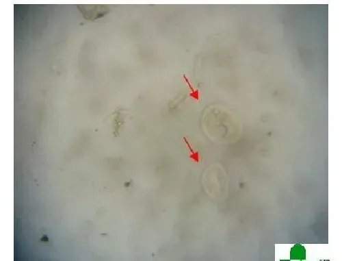 淡水鱼养殖常见病斜管虫病的防治方法