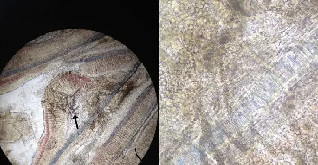 【技术分享】浅谈鱼类鳃霉病的诊断和防控方法