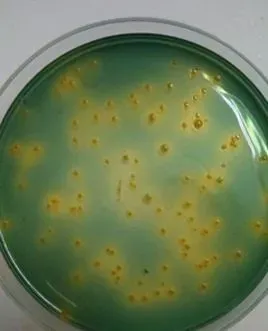南美白对虾塘弧菌或革兰氏阴性菌超标解决办法