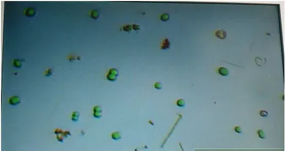 弧菌推论：单一藻相占优势的南美白对虾塘，感染几率高